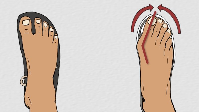 Ilustracija poređenja barefoot obuće i klasične cipele, prikaz položaja prstiju